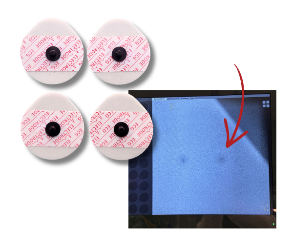 radiotransparent ECG electrodes invisible under imaging