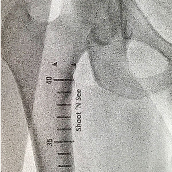 shoot-n-see-xray-600x600