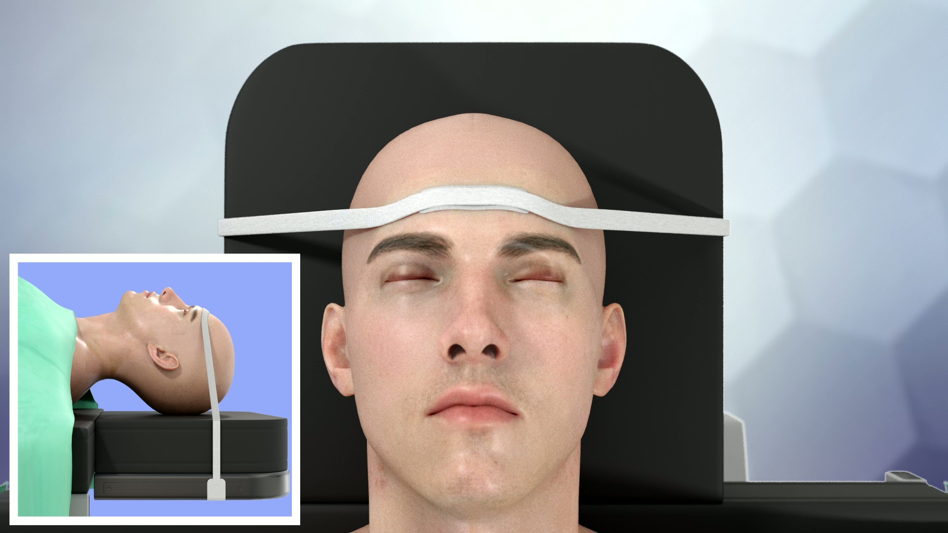 Cranial Immobilization System Application
