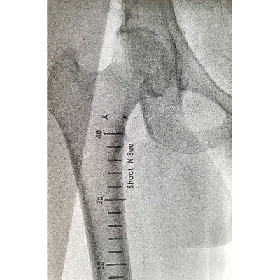 shoot-n-see-xray-1